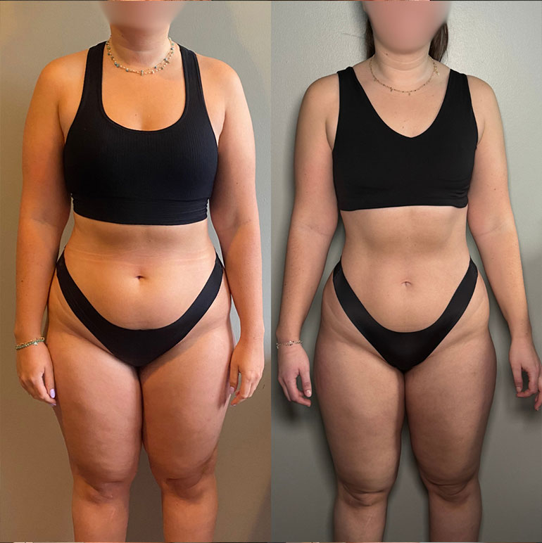 Transformation 1