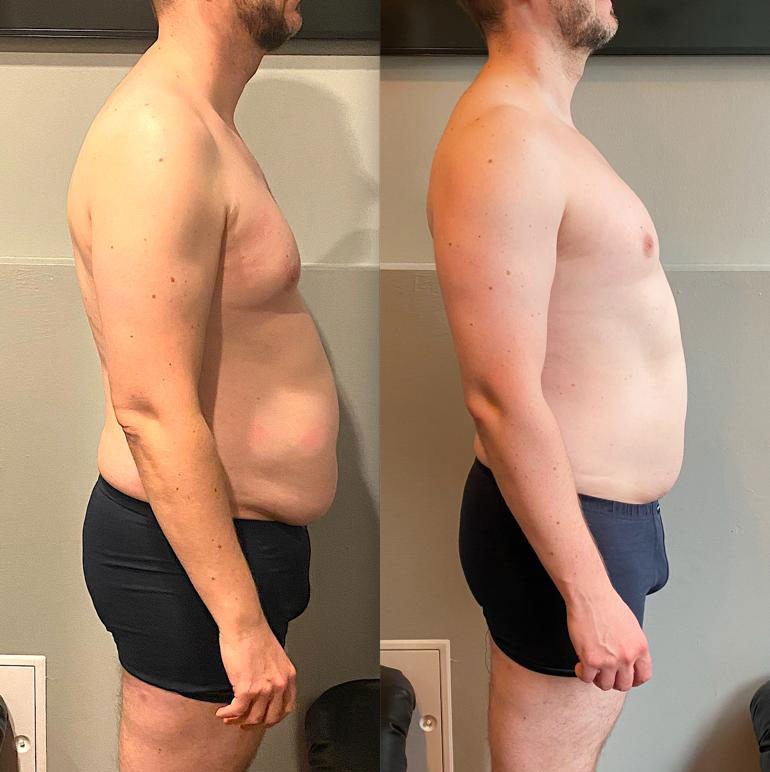 Transformation 2